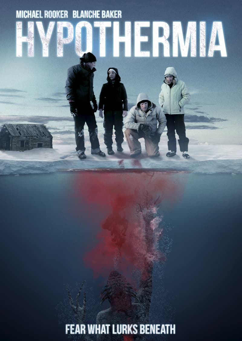 Hypothermia